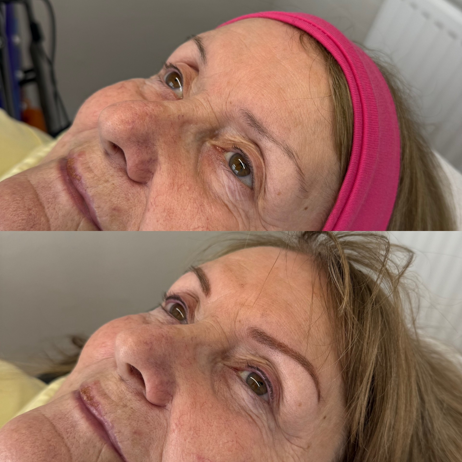 Before and after microblading treatment